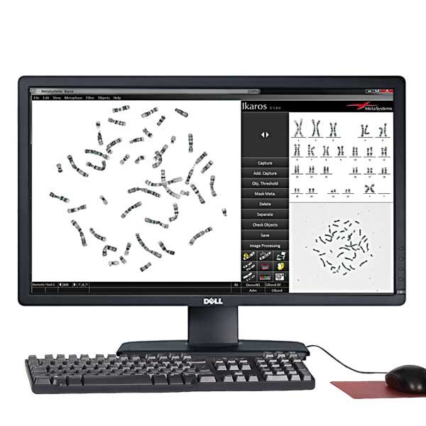 The innovative imaging software Ikaros combines